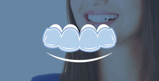 invisalign aligner illustration